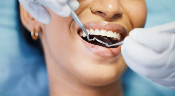 Best Emergency Treatment for Dental Infections or Abscesses in Brass Castle, NJ